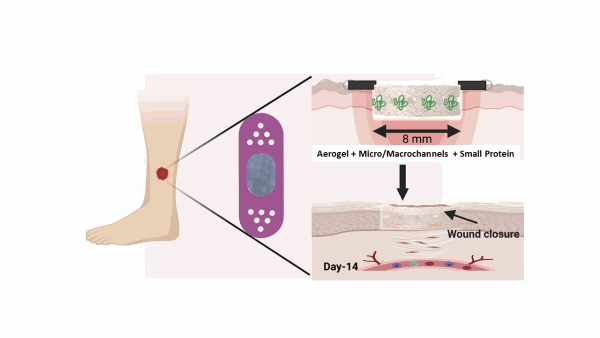 Microchannel-Containing Nanofiber Aerogels with Small Protein Molecule Enable Accelerated Diabetic Wound Healing