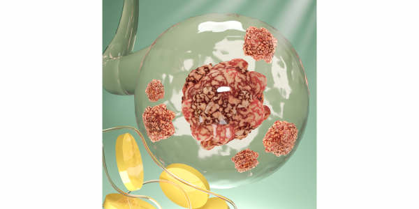 Enhanced Tumor Modeling Using Laponite Bioinks for 3D Bioprinting 